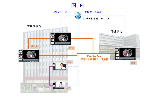 遠隔医療