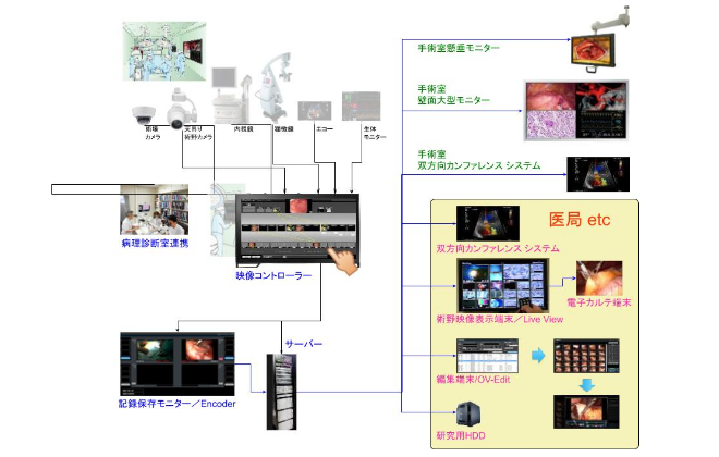 Opera Vision