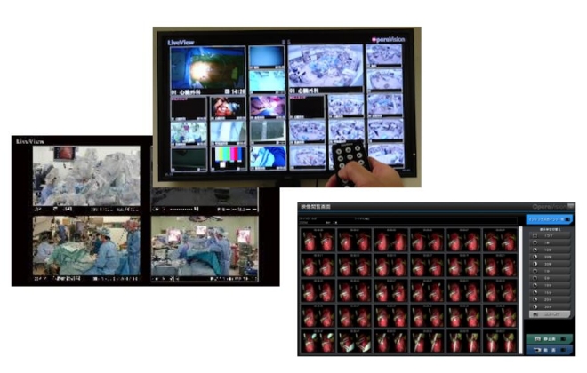見せたい瞬間に、すぐ届く。医療映像活用を劇的にスマートにする OperaVision。